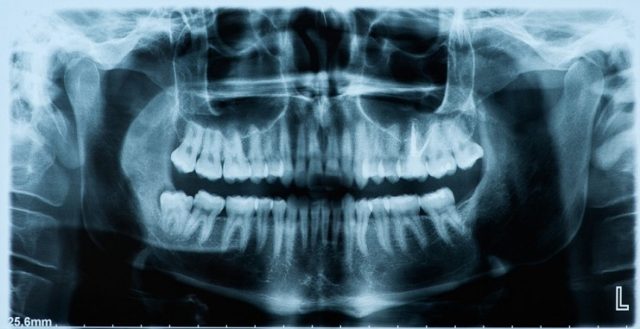 teeth